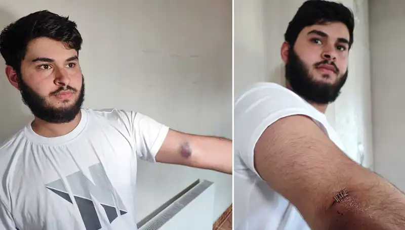 Bahçede Kaybolan Top, Mahallede Olay Yarattı: "Conolar Kamyonetle Geldi"