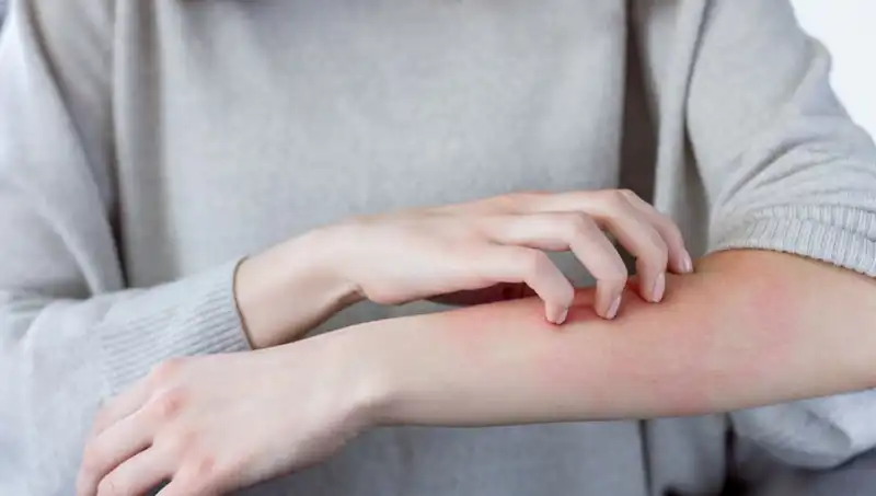 Gözden Kaçırılan İki Belirti: Dermatologdan Cilt Kanseri Uyarısı