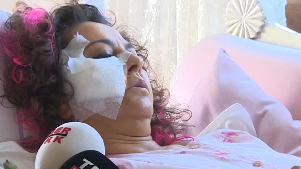 Başıboş köpeklerin saldırısına uğrayan akademisyen